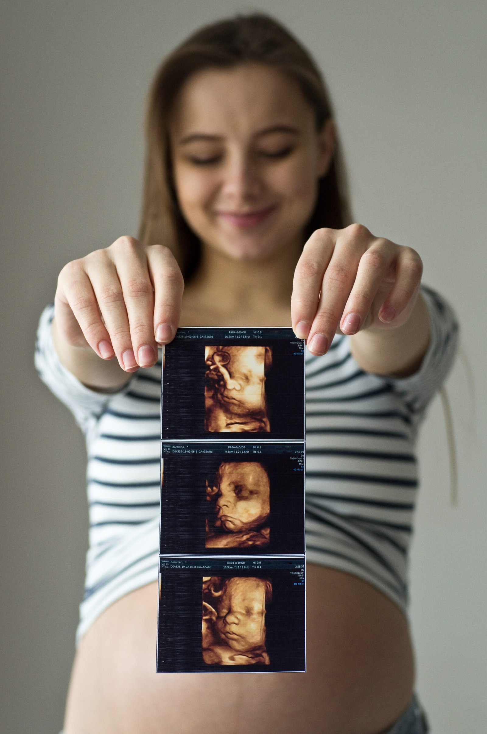 pregnant-woman-holding-ultrasound-image-concept-pregnancy